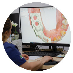 surgical-guides-for-implants